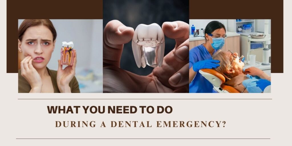What You Need To Do During A Dental Emergency?