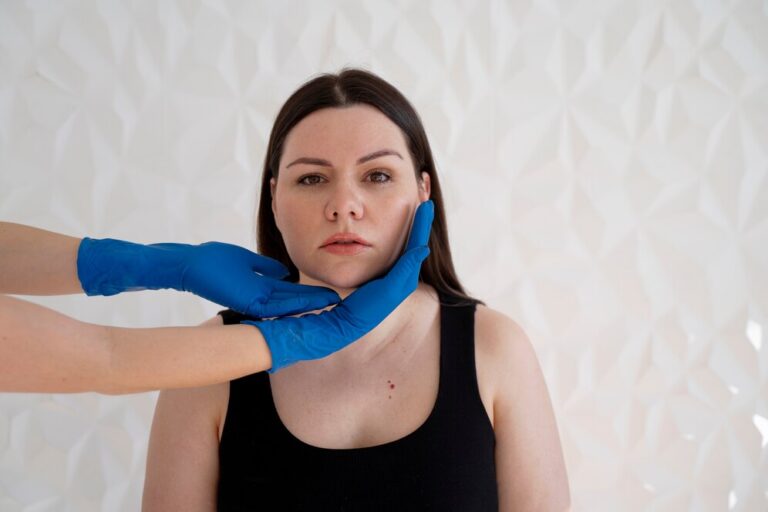 Hyperpigmentation Treatment near me