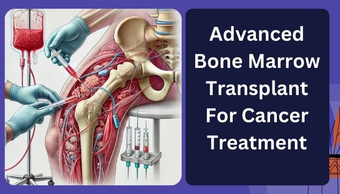 Advanced Bone Marrow Transplant For Cancer Treatment