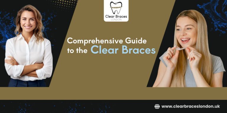 An All-in-One Comprehensive Guide to the Clear Braces