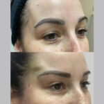 How to Choose the Best Aesthetic Clinic in Dubai for Thread Lifts