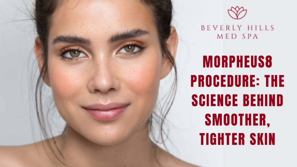 Morpheus8 procedure
