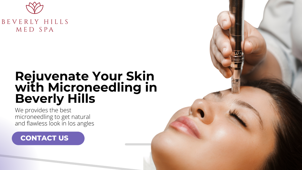 Microneedling in Beverly Hills
