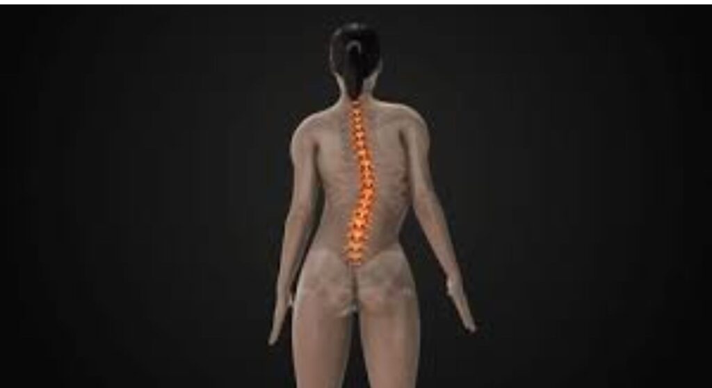 Scoliosis Surgery image