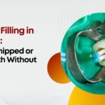 composite filling in front teeth