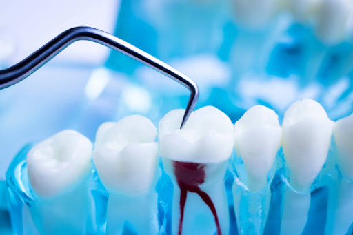 Emergency Dentist Fort Worth TX: Get Fast Relief & 1 Day Dental Implants