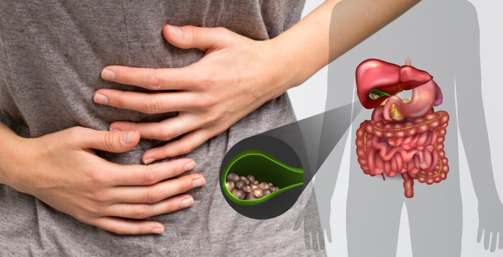 stone in liver symptoms