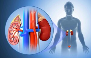 How To Choose the Best Hospital for Your Kidney Transplant