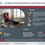 Global Non-Hodgkin Lymphoma (NHL) Market Research Report Forecast (2022-27)