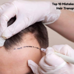 Hair transplant recovery