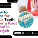 How to Care for Your Teeth After a Root Canal in Sharjah