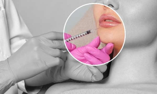 Lipfillers