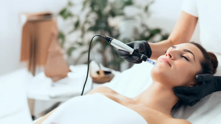 RF microneedling treatment in London