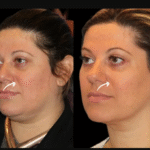 Best Aesthetic Clinic in dubai