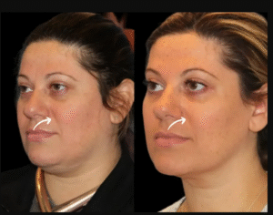 Best Aesthetic Clinic in dubai