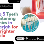 Top 5 Teeth Whitening Clinics in Sharjah for a Brighter Smile