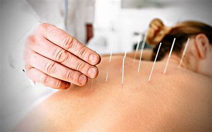 acupuncture for athletes