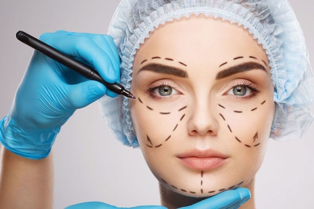 eye bag surgery
