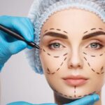 eye bag surgery