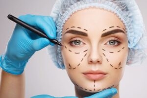 eye bag surgery