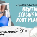 Dental Scaling and root planing in London