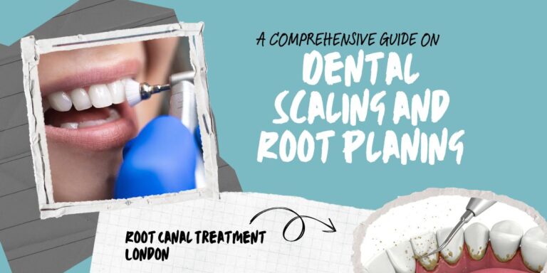 Dental Scaling and root planing in London