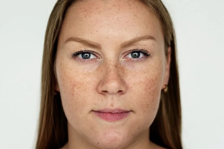 Can Dermal Pigmentation Removal Improve Skin Glow?