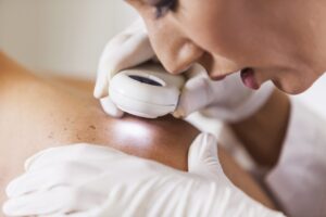 Dermatologist Silicon Oasis