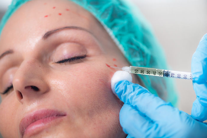 Vampire Facial in Dubai