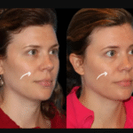 Best Aesthetic Clinic in dubai