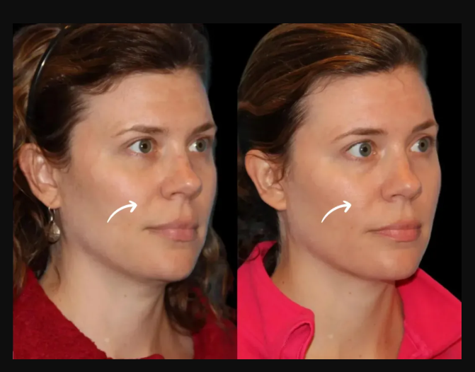 Best Aesthetic Clinic in dubai