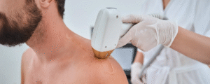 Birthmarks Removal Treatment in Dubai