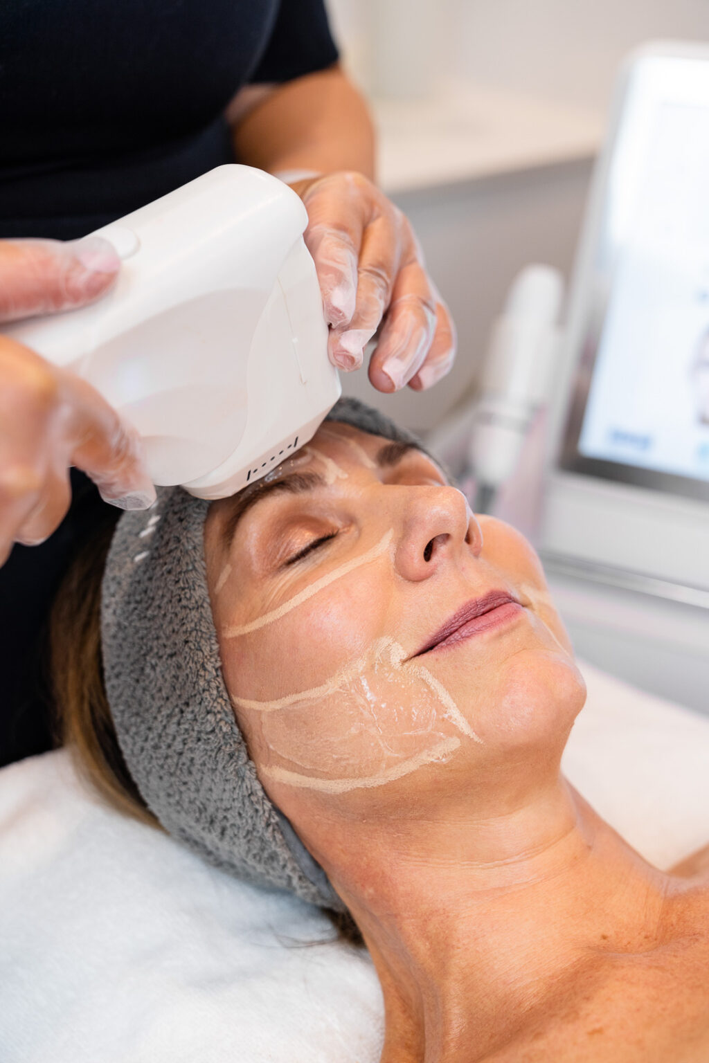 Hifu Treatment Dubai