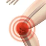 Best Knee Replacement Surgeon in Jaipur