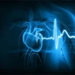 best-ct-angiography-in-dubai/