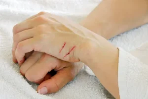 fast-first-aid-for-cuts-and-scrapes

