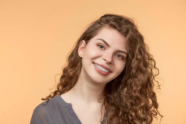 clear ceramic braces