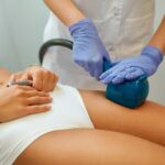 Velashape 3 Treatment in Dubai