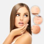 Skin Whitening Treatment in Dubai