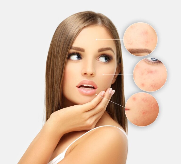 Skin Whitening Treatment in Dubai