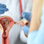 gynecologist in Malaysia