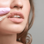 What Is the Best Age to Get Lip Fillers Done?