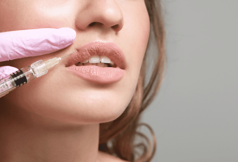 What Is the Best Age to Get Lip Fillers Done?