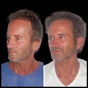 Best Aesthetic Clinic in dubai