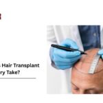 hair transplant recovery