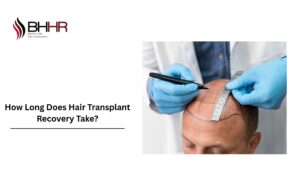 hair transplant recovery