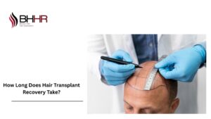 hair transplant recovery
