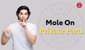 Mole on Private parts