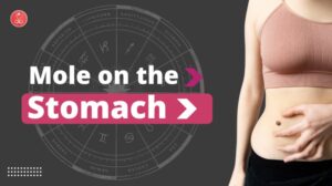 Mole on the Stomach