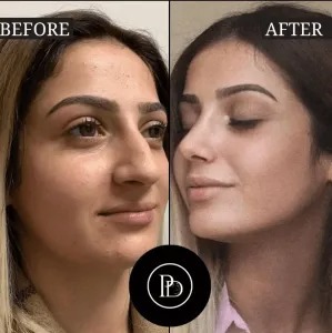 Best Doctors in Dubai for Skin Brightening and Glow